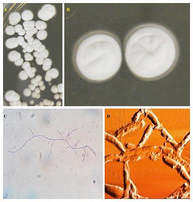 The Potential Use of Actinomycetes as Microbial Inoculants and Biopesticides in Agriculture